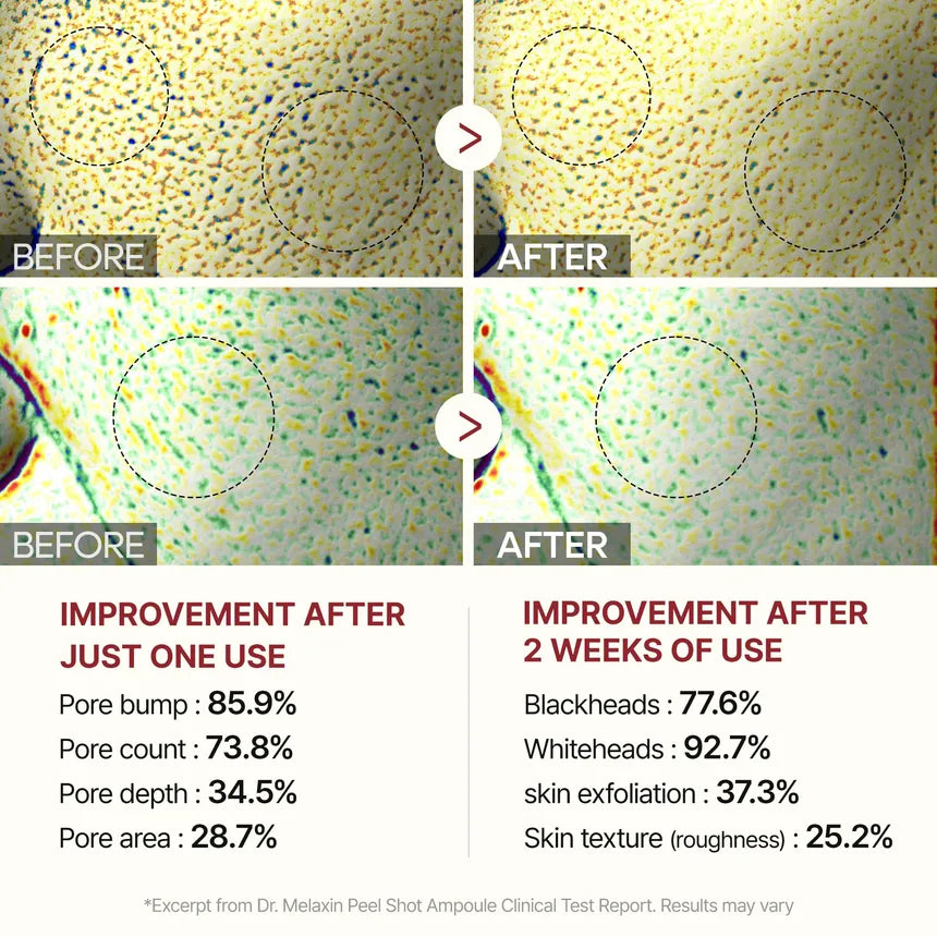 Dr. Melaxin - Peel Shot Exfoliant Black Rice Ampoule