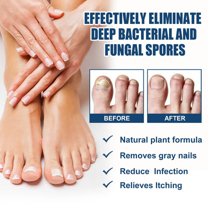 Anti-Fungal Foot Spray