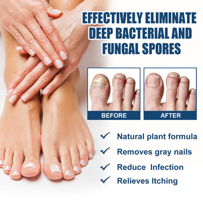 Anti-Fungal Foot Spray