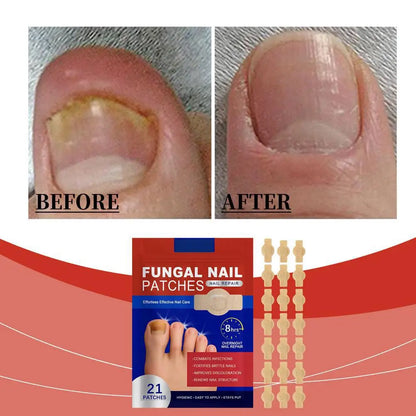 Fungus Nail Repair Patches 21 Patches