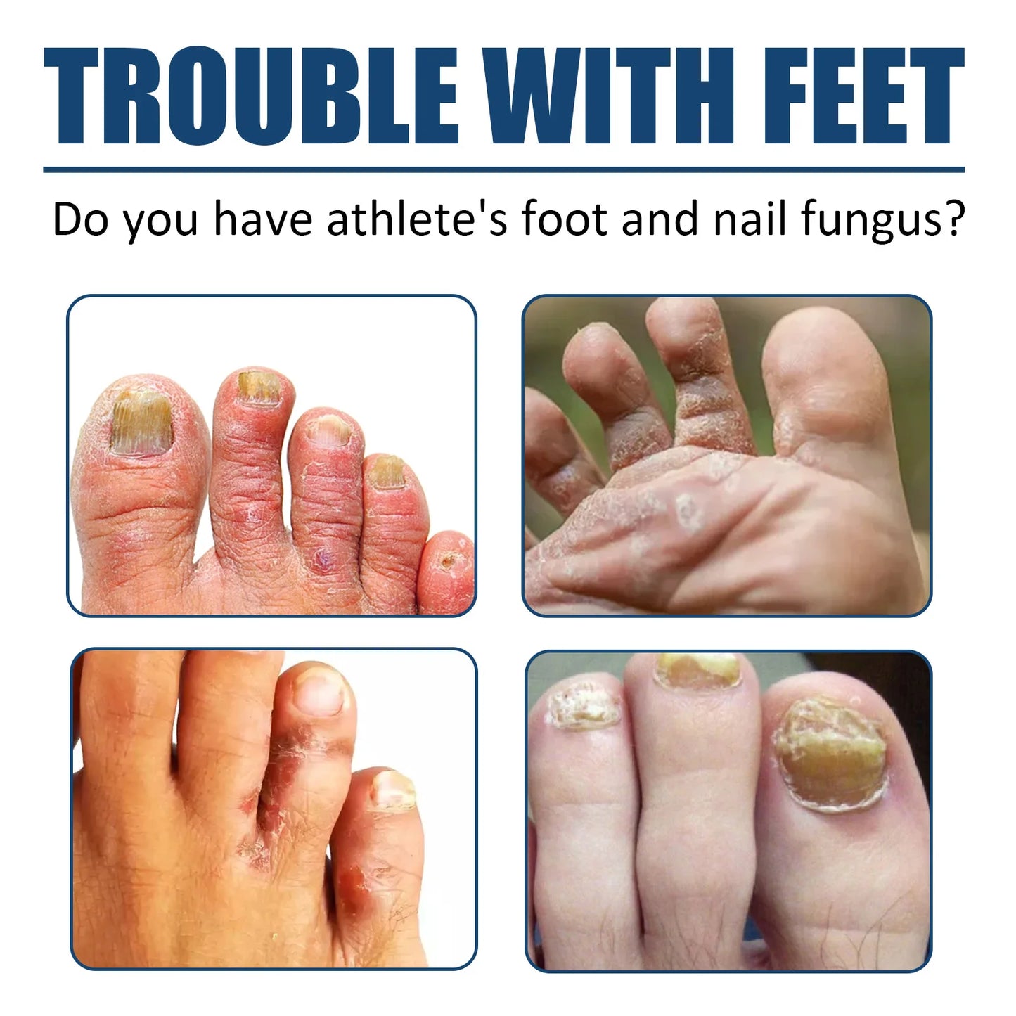 Anti-Fungal Foot Spray