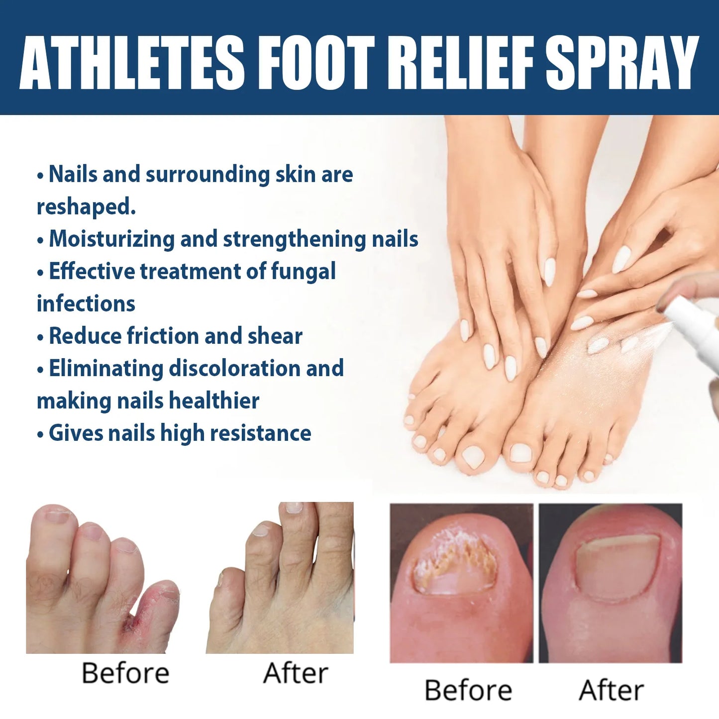Anti-Fungal Foot Spray