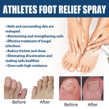 Anti-Fungal Foot Spray