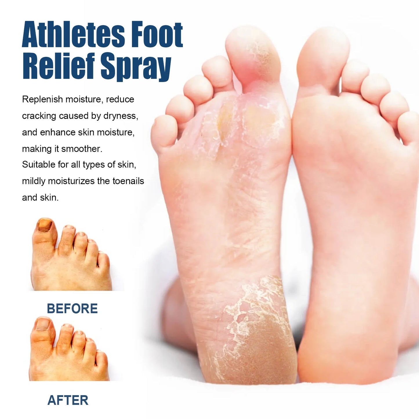 Anti-Fungal Foot Spray