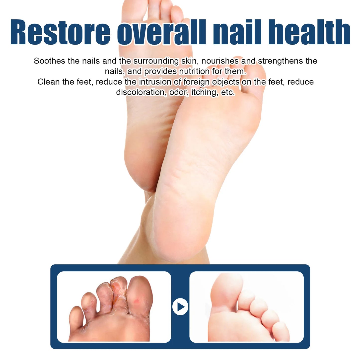 Anti-Fungal Foot Spray